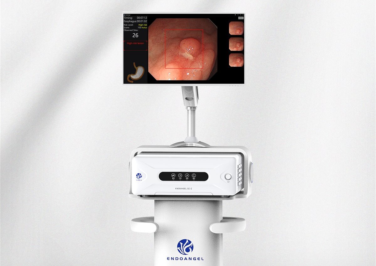 EndoAngel Colonoscopy AI Assistant product brochure
