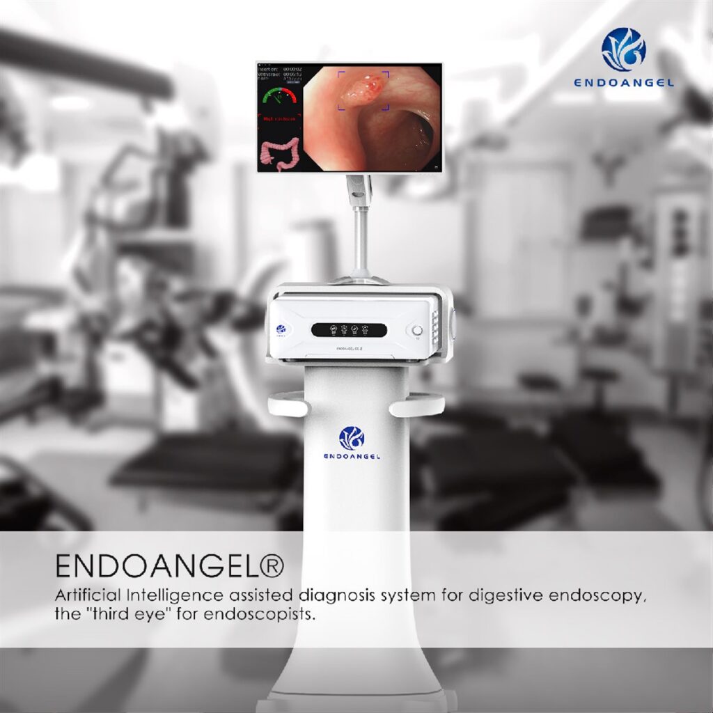 EndoAngel colonoscopy AI assistant in clinical use