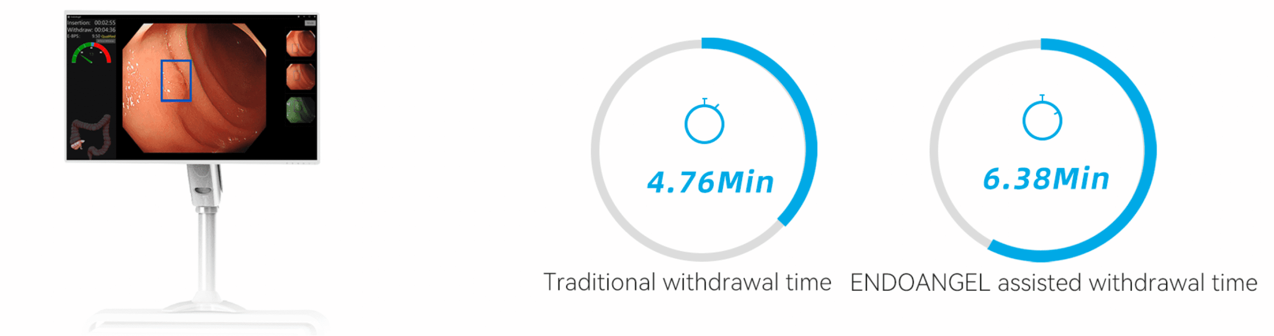 ENDOANGEL withdrawal time comparison