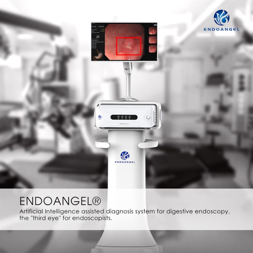 EndoAngel upper GI AI assistant in clinical use